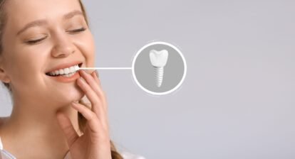 dental implants